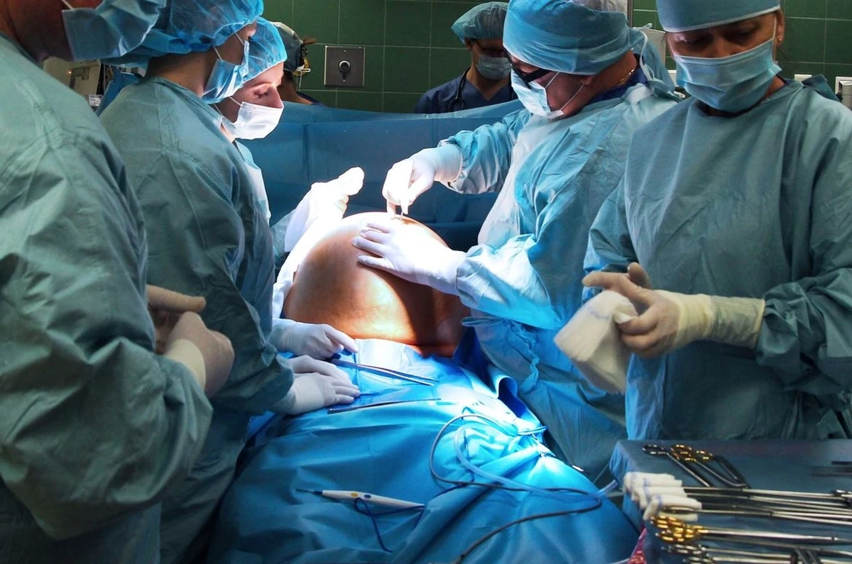 Lekarze z Grudziądza w woj. kujawsko-pomorskim usunęli pacjentce guz, który miał 40 cm i ważył ponad 14 kg. Jak się okazało, kobieta od ponad 30 lat nie była u ginekologa.  