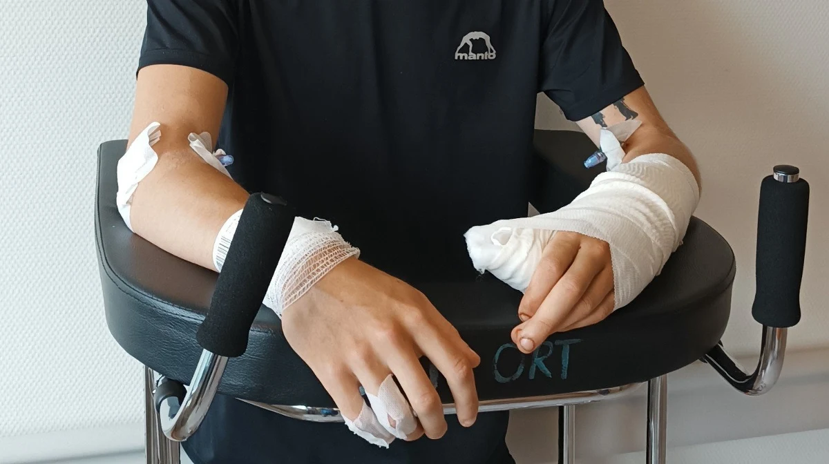 201 675 zł - tyle udało się zebrać na rehabilitację 17-letniego Artioma z Ukrainy, któremu bandyci na Zakrzówku w Krakowie odcięli palec oraz uszkodzili mózg uderzając maczetą w czaszkę. Zrzutkę pieniędzy uruchomił były krakowski radny, Łukasz Wantuch. Kwota, która była potrzebna na pomoc nastolatkowi to 200 000 zł, jednak 3370 wspierających było bardziej hojnych.  