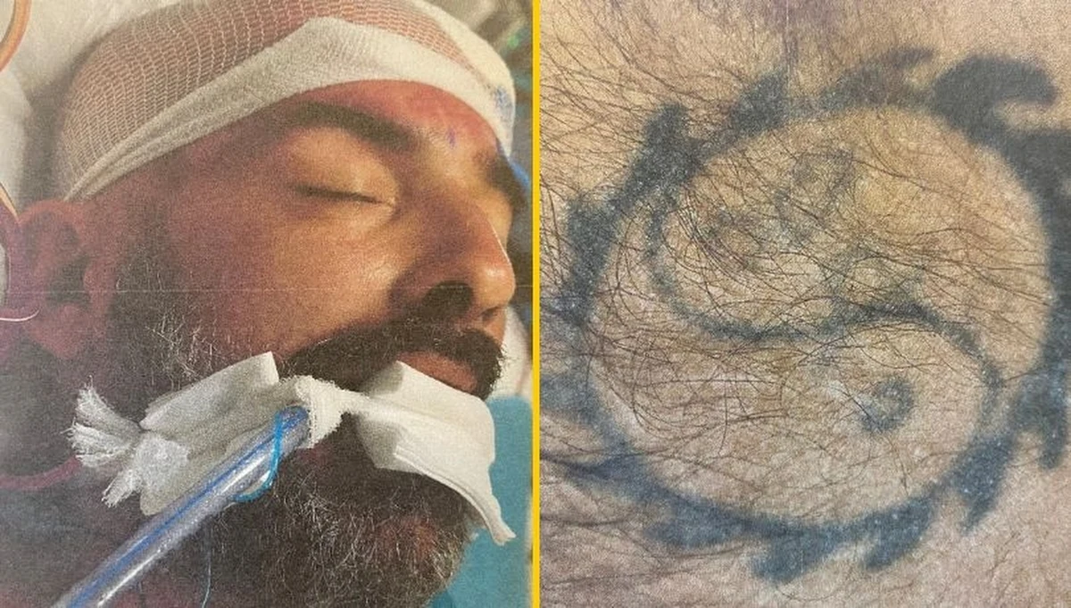 Policja próbuje ustalić, kim jest mężczyzna potrącony 13 sierpnia na drodze miedzy Słubicami a Drzecinem w woj. lubuskim. Obecnie przebywa on w szpitalu. Funkcjonariusze publikują zdjęcia mężczyzny oraz jego tatuażu. Mają nadzieję, że ktoś go rozpozna. 