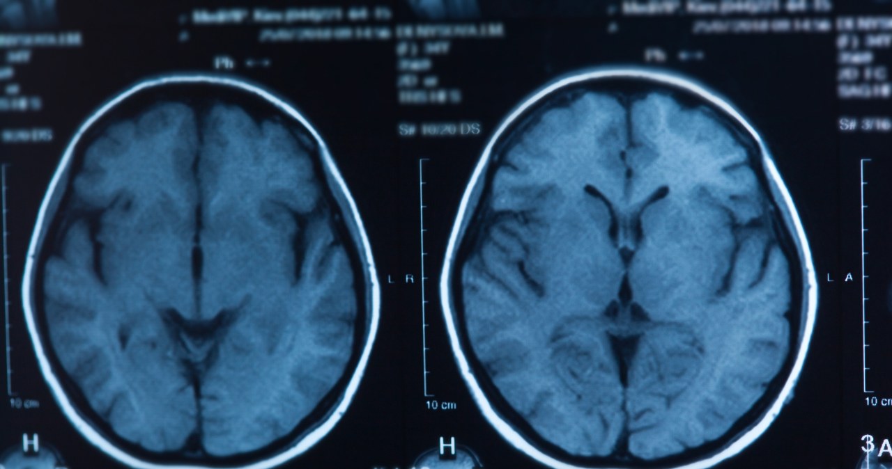 Pięć faz rozwoju mózgu człowieka. Kiedy następują przełomowe zmiany?