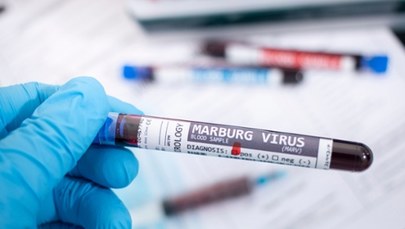 Ten kraj zmaga się z epidemią wirusa Marburg. WHO o ryzyku zakażeń na świecie