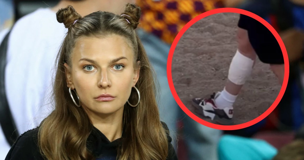 Anna Lewandowska pokazała, jak wygląda noga Roberta Lewandowskiego po faulu Livakovicia