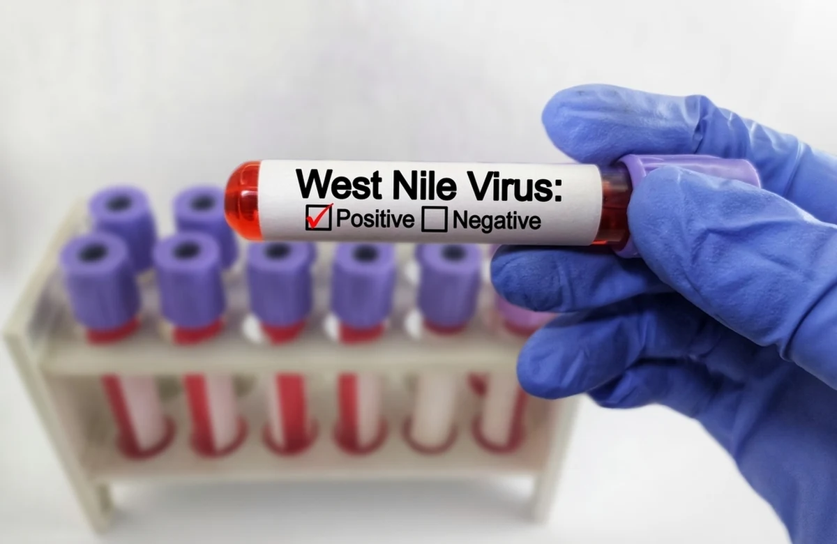 Kolejny przypadek zakażenia wirusem gorączki zachodniego Nilu został potwierdzony w sobotę przez Głównego Inspektora Sanitarnego Pawła Grzesiowskiego. "Choć wirus jest ten sam, to miejsce jego zakażenia jest zupełnie inne niż przypadku ze środy" - zaznaczył Grzesiowski.