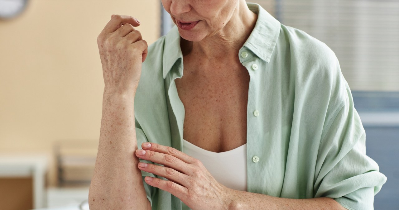 Choroby jelit, wątroby lub trzustki, które widać na skórze. Objawy są mylące