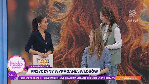 Wypadanie włosów to zmora wielu kobiet, która zwłaszcza jesienią mocno daje się we znaki. Trycholożka Magdalena Szymczak-Kępka zdradziła w “halo tu polsat” najlepsze domowe sposoby na zahamowanie utraty włosów. Podpowiedziała też, jak je czesać i jakie szczotki czynią najmniej zniszczeń na naszych głowach.