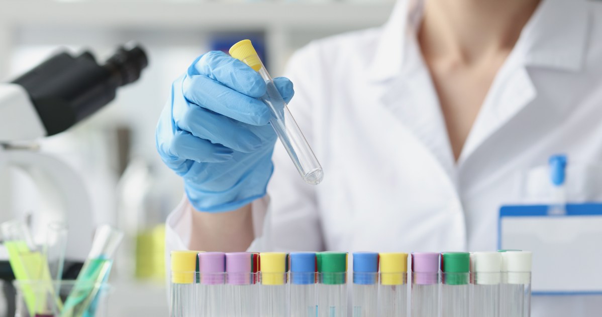 Pytania o badania. Kiedy należy oznaczyć poziom bilirubiny?