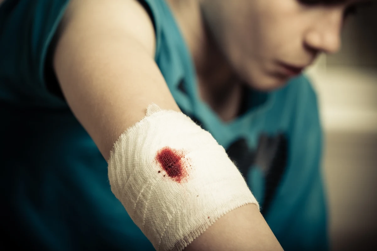 11-letni chłopiec, bawiąc się wiatrówką, postrzelił kolegę. Jak ustalił reporter RMF MAXX Kamil Puternicki, ciechanowska policja wyjaśnia okoliczności zdarzenia, do którego doszło w miejscowości Sarnowa Góra w gminie Sońsk (woj. mazowieckie).