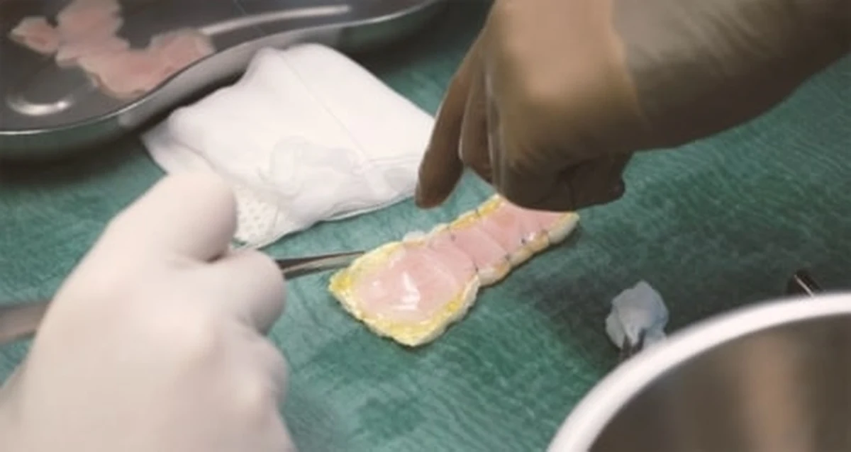 Niemieccy naukowcy z Uniwersytetu Medycznego w Getyndze dokonali przełomu, regenerując uszkodzone serce 46-letniej pacjentki za pomocą "łaty" z mięśnia sercowego wyhodowanej w laboratorium. Metoda ta może otworzyć nowe możliwości leczenia dla milionów osób cierpiących na zaawansowaną niewydolność krążenia.