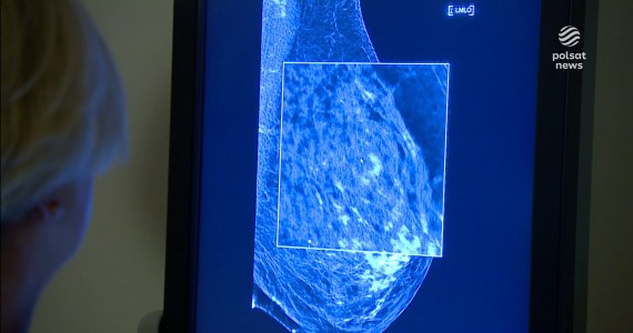 "Wydarzenia": Polki się nie badają. Rak piersi wykrywany za późno