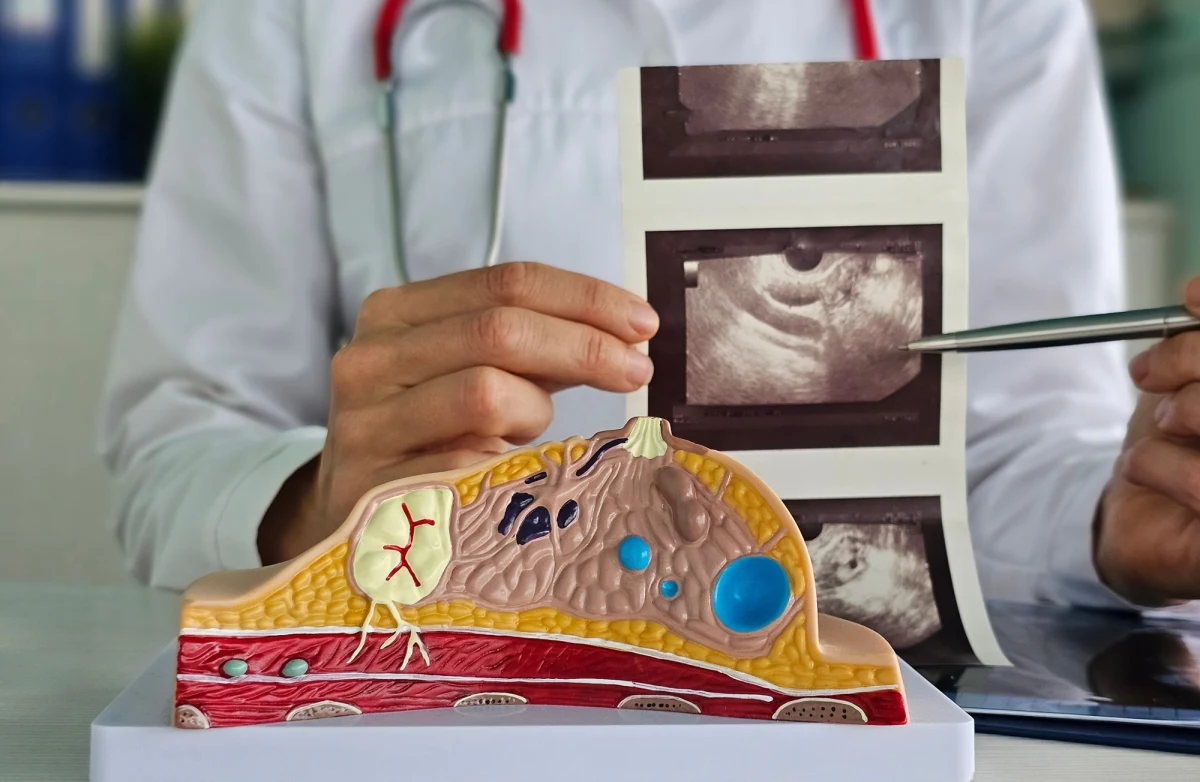 Procedury chirurgii plastycznej polegające na odsysaniu tkanki tłuszczowej w jednych miejscach i przeszczepianiu w inne nie wydają się naturalną inspiracją dla interwencji onkologicznych. Naukowcy z University of California w San Francisco opisują jednak na łamach czasopisma "Nature Biotechnology" wyniki badań, które mogą to zmienić. Okazuje się, że przeszczepienie myszom cierpiącym na raka odpowiednio zmodyfikowanych komórek tłuszczowych pozwala komórki nowotworowe dosłownie zagłodzić. 