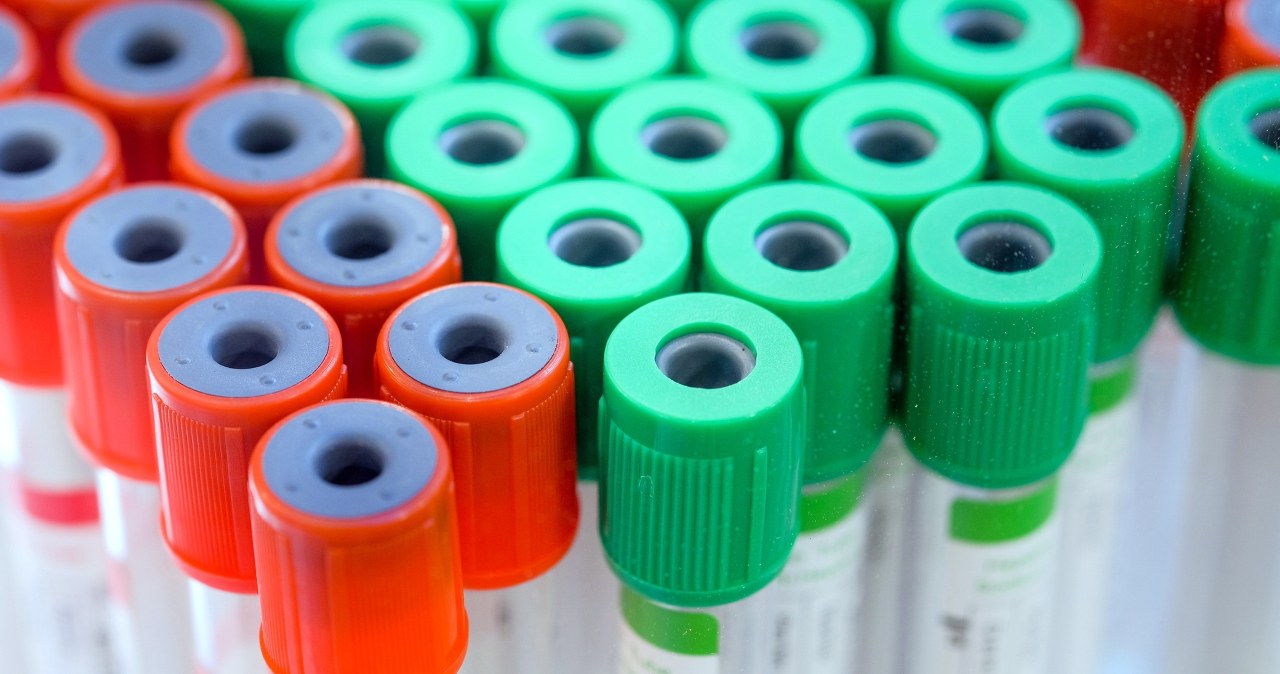 7 powodów dla których warto oznaczyć poziom kwasu moczowego