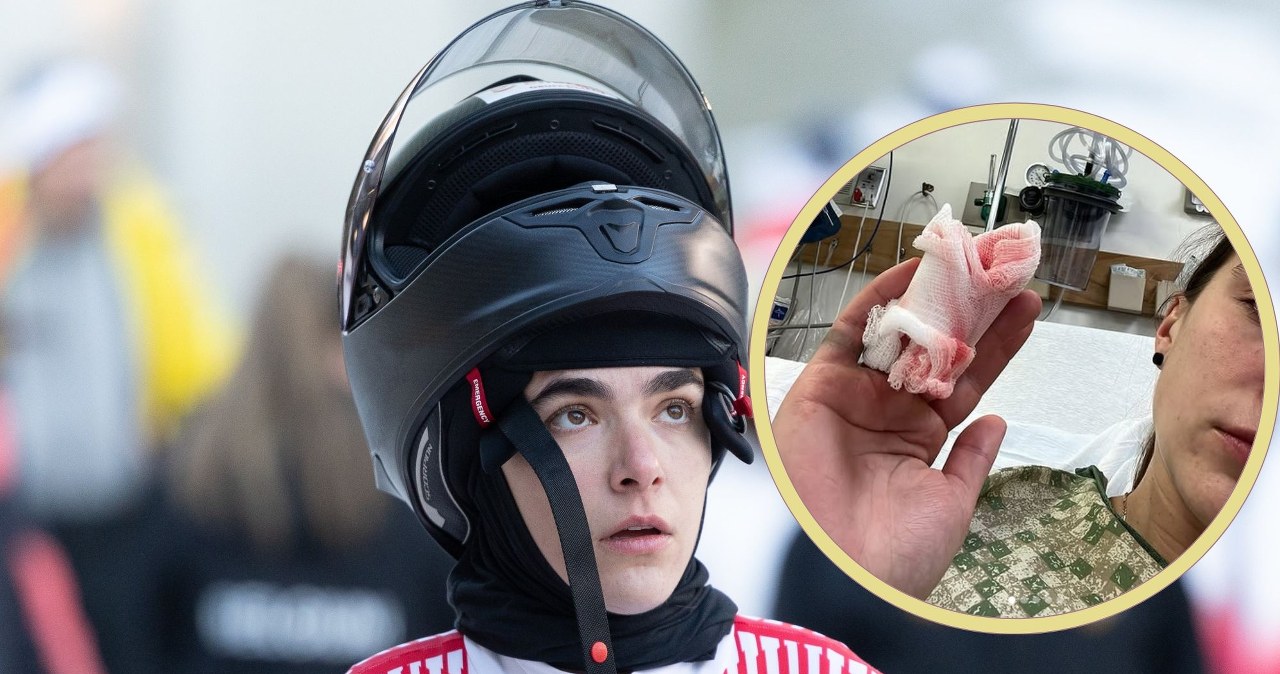 Wstrząsająca relacja polskiej medalistki mistrzostw świata. "Nie było szansy na przyszycie palca"