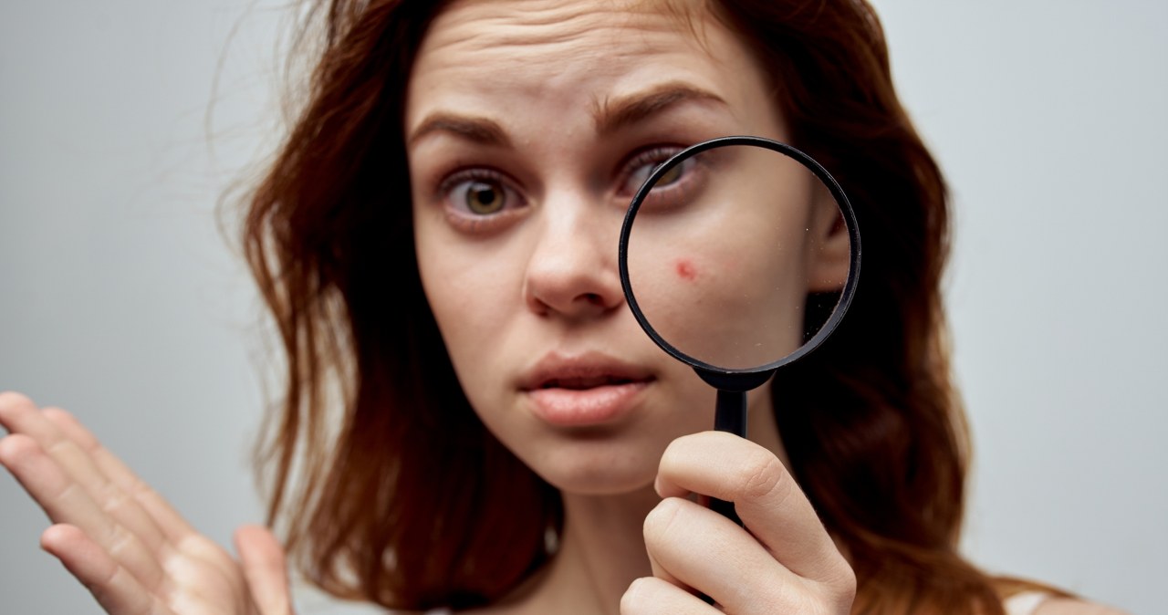 Nie wyciskaj, tylko sięgnij do kuchennej szafki. Domowe mikstury i plastry na wągry i pryszcze