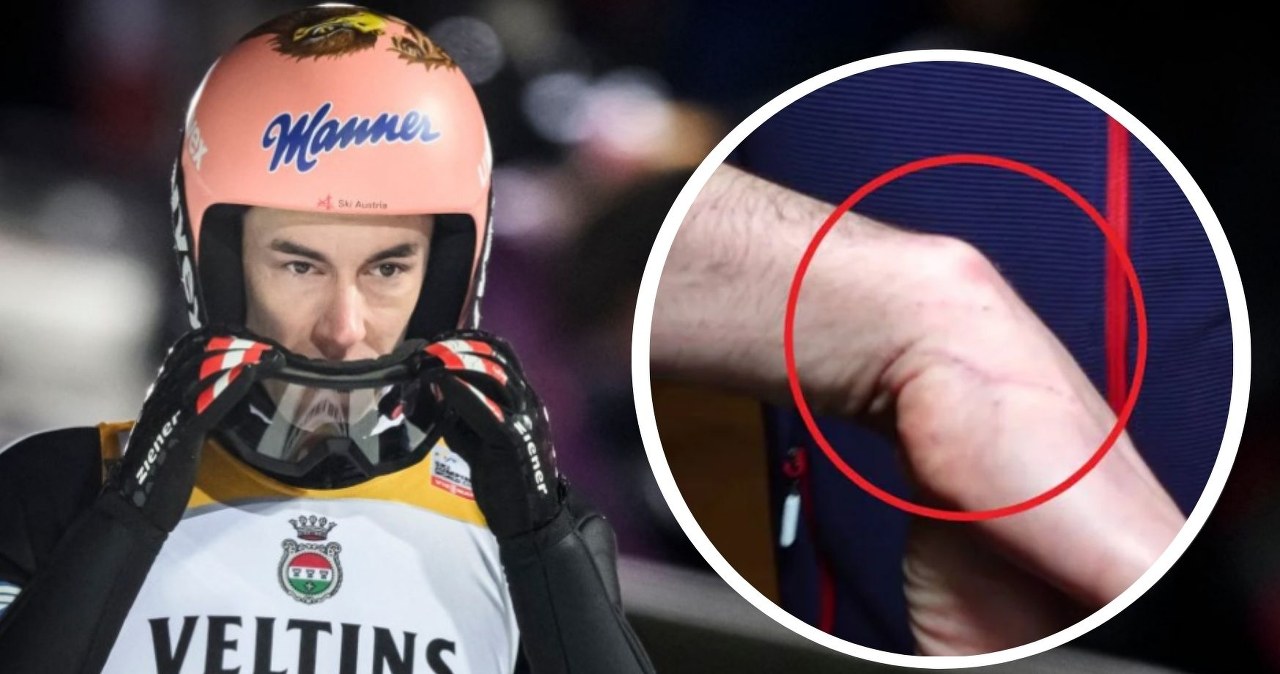 Absurdalny uraz Krafta, winowajcą... kot. Norwegowie wybuchnęli śmiechem, jest już zdjęcie