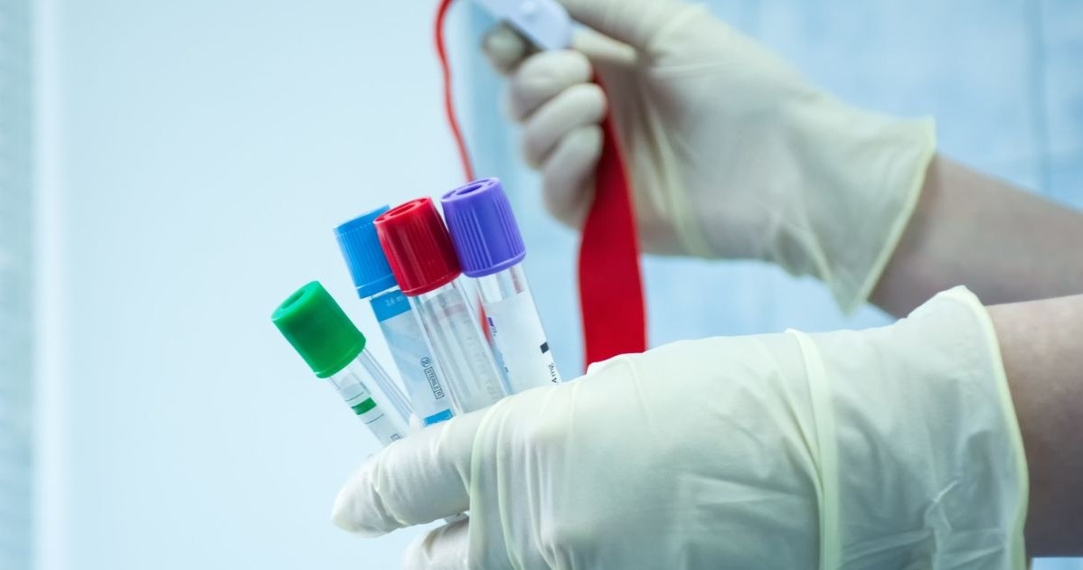 Nowe normy lipidogramu. Jak czytać lipidogram i co trzeba o nim wiedzieć?