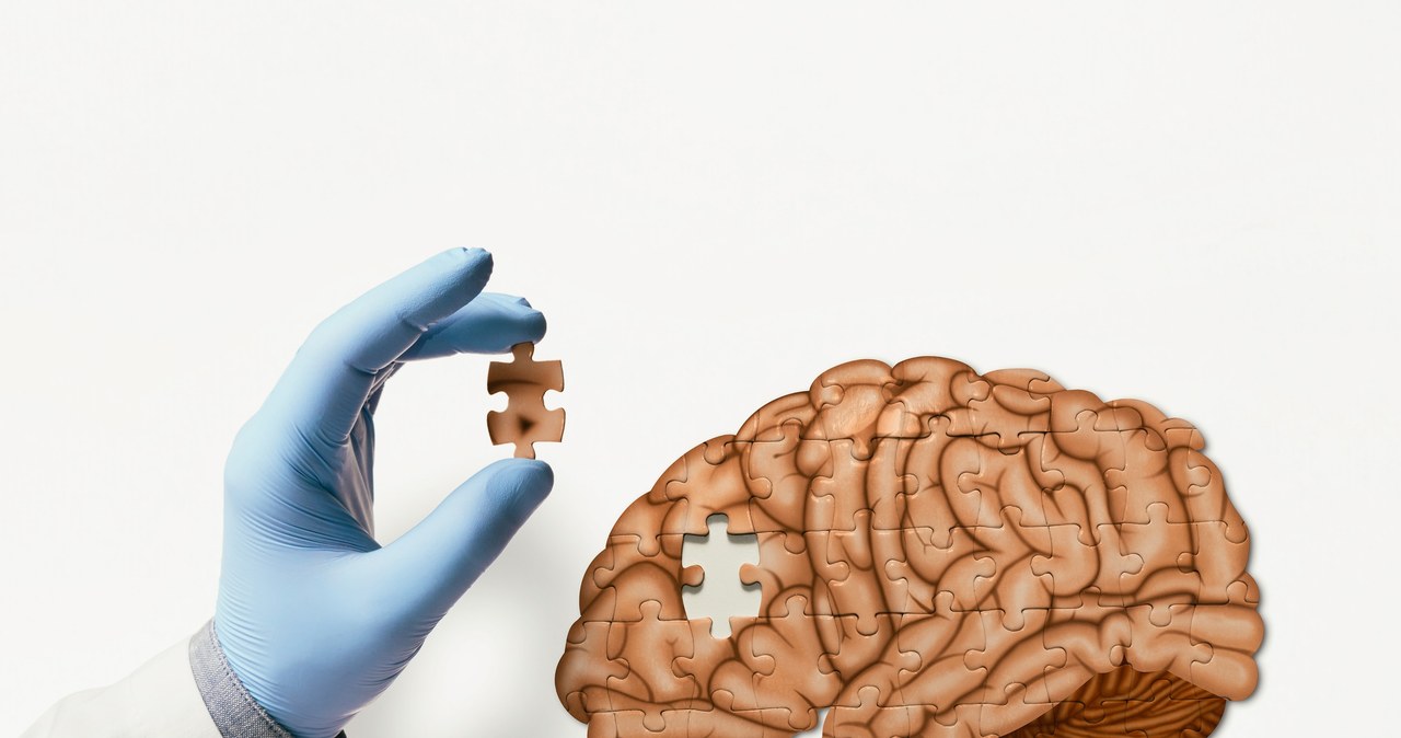 Choroba Alzheimera dotyka młodych. Odkryto niepokojące dane
