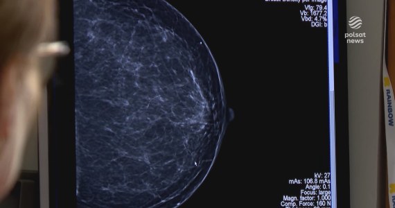 "Wydarzenia": Krajowa Sieć Onkologiczna. Program rusza z rocznym opóźnieniem