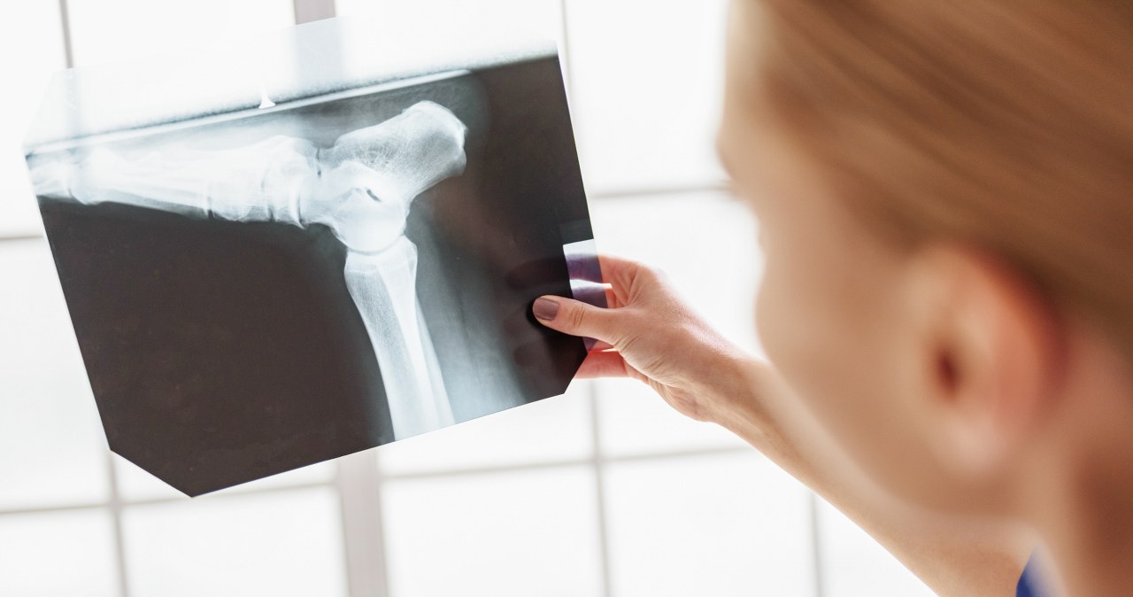 Odczytali, jak ćwiczenia budują mocniejsze kości. Osteoporoza nie ma szans