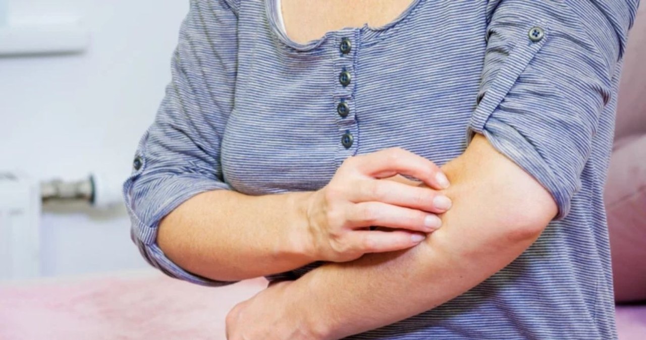 Jedz, a złagodzisz świąd i łuszczenie. Produkty zalecane są w chorobach skóry