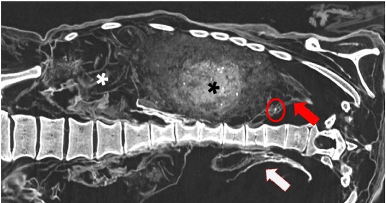 Naukowcy rozwiązali zagadkę dziwnej mumii. Nieznane praktyki