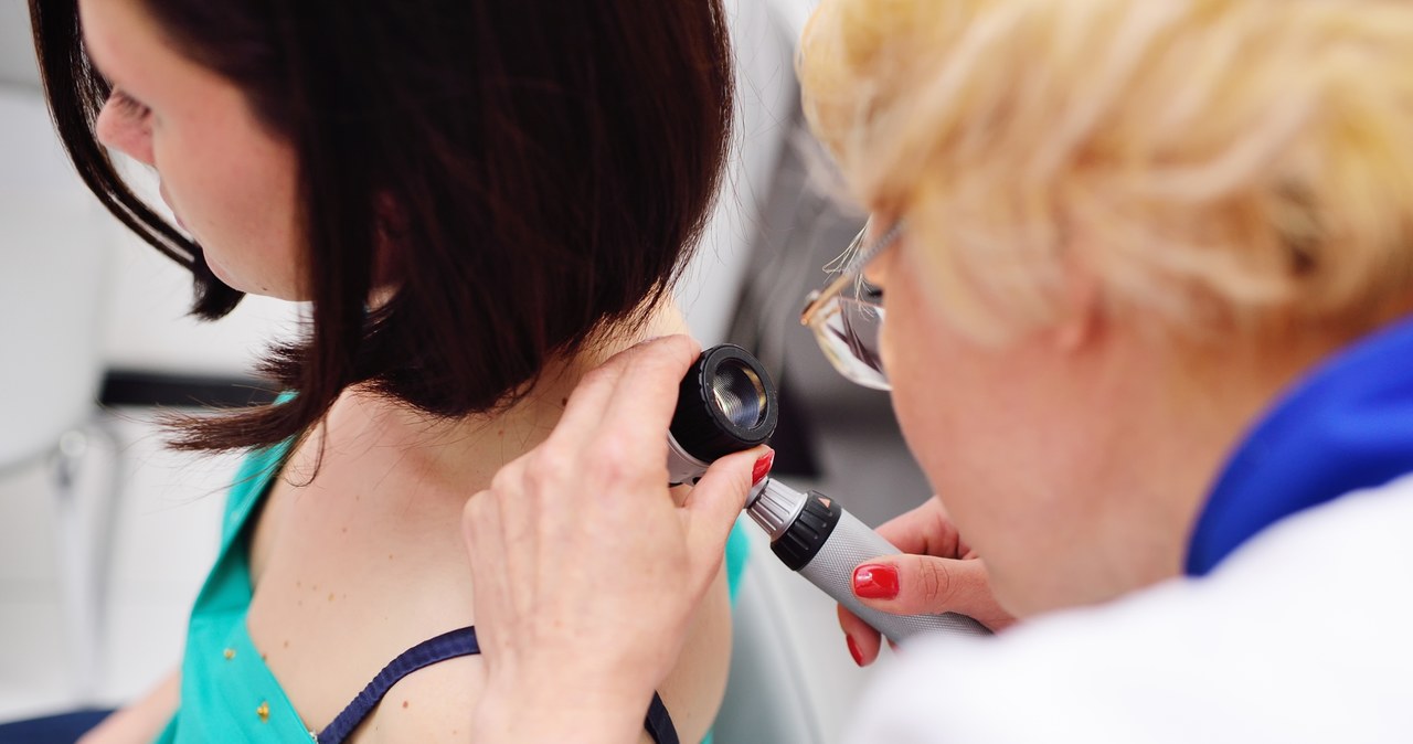 Jak wygląda czerniak? Jak diagnozuje się czerniaka? Ważne są też te badania