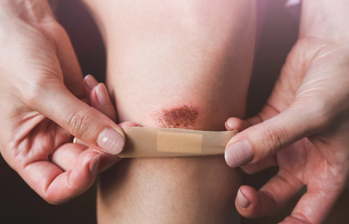 ​Czy wiesz, że nasze rany goją się znacznie wolniej niż u szympansów czy myszy? Najnowsze badania międzynarodowego zespołu naukowców ujawniają, że rany u ludzi goją się aż trzy razy wolniej niż u innych naczelnych i gryzoni. To odkrycie rzuca nowe światło na ewolucję człowieka i może mieć wpływ na przyszłość medycyny regeneracyjnej.