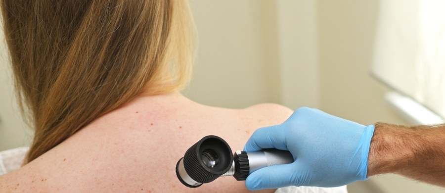 Czerniak atakuje. Nowotwór jeszcze trzydzieści lat temu diagnozowany był w naszym kraju u niemal półtora tysiąca osób rocznie. Teraz liczba ta przekracza cztery tysiące. Choroba na wczesnym etapie jest całkowicie wyleczalna, natomiast zaniedbana i zaawansowana zmiana - to walka o życie. A wystarczy chronić i obserwować skórę oraz kontrolować znamiona, o czym przypominamy przy okazji Europejskiego Dnia Walki z Czerniakiem.