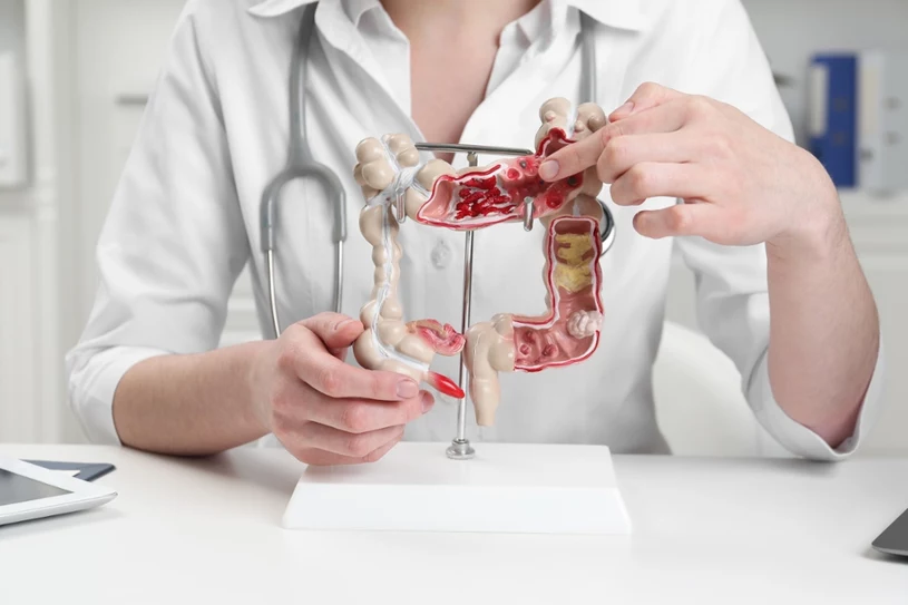 HUMAN GUT MICROBIOTA, czyli jak mikrobiota bakteryjna człowieka zachowuje się w kosmosie