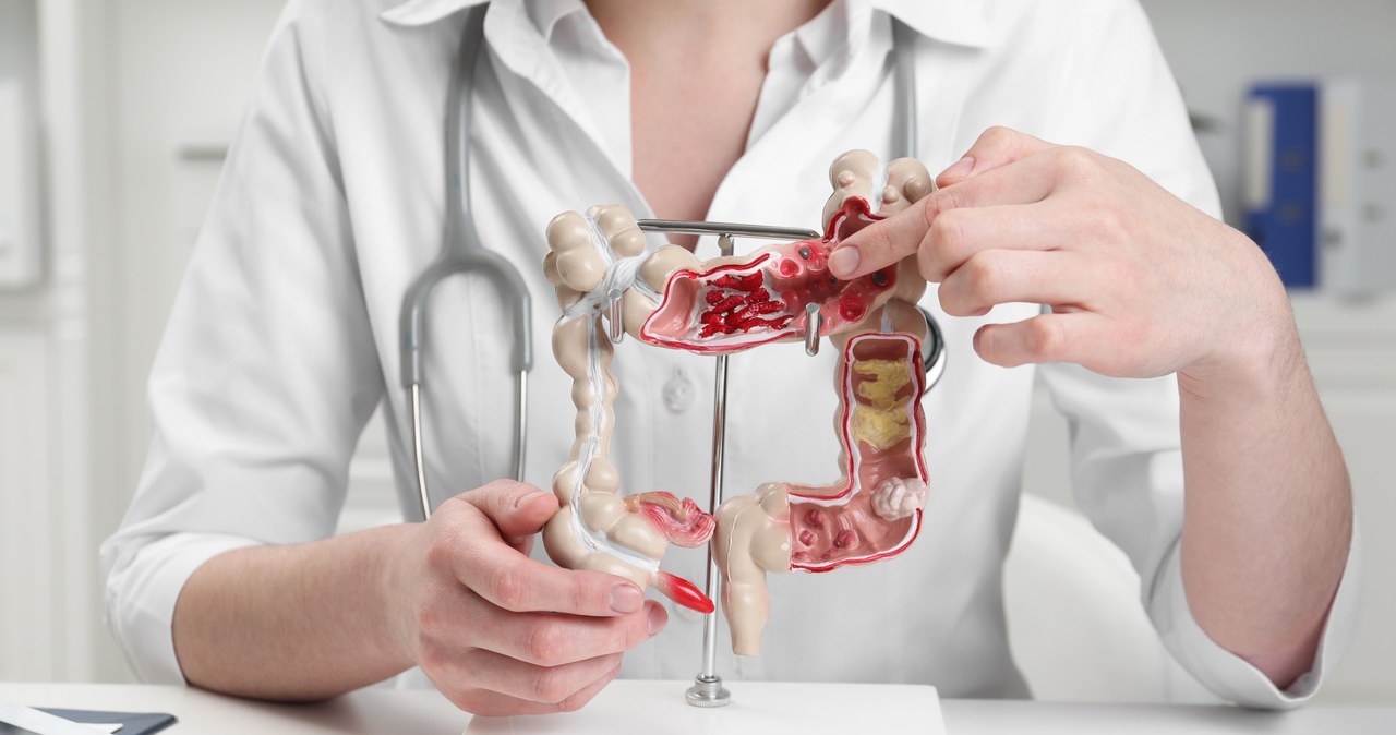 HUMAN GUT MICROBIOTA, czyli jak mikrobiota bakteryjna człowieka zachowuje się w kosmosie