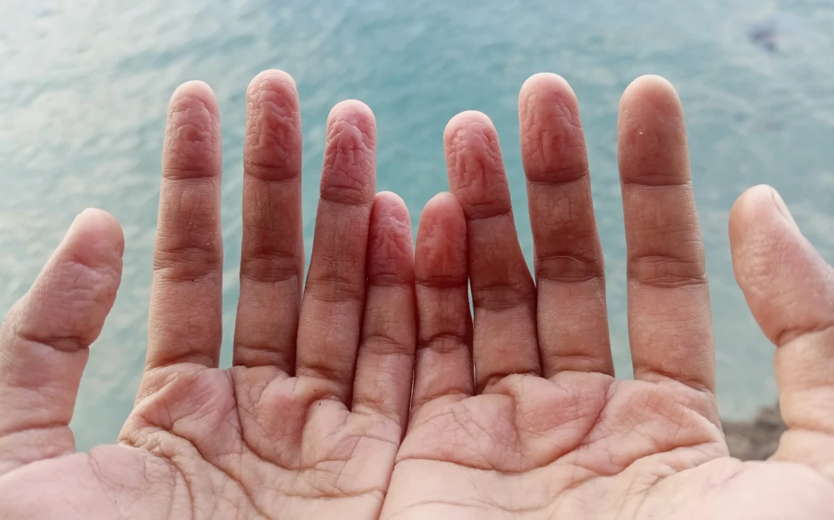 To nie mit ani przypadek - zmarszczki na opuszkach palców po kąpieli układają się zawsze w ten sam sposób. Naukowcy odkryli, że wzór, który tworzy się na naszej skórze po dłuższym kontakcie z wodą, może być unikalny i powiązany z naszym układem nerwowym. Co więcej, odkrycie to może znaleźć zastosowanie nawet w medycynie sądowej.