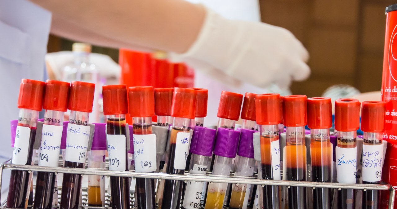 Zdjęcie zamiast pobrania krwi. Apka pomaga wykryć zaburzenie