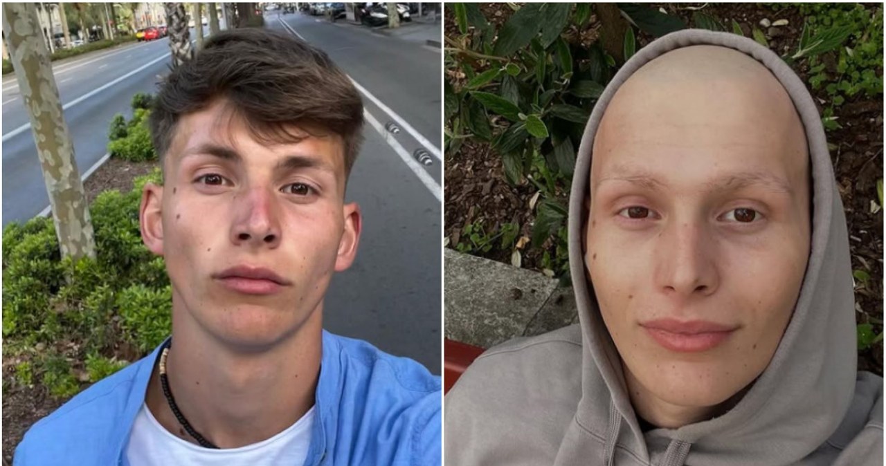 21-letni lekkoatleta walczy o życie. Pisze o "bohaterze z Polski" i zwraca się z apelem