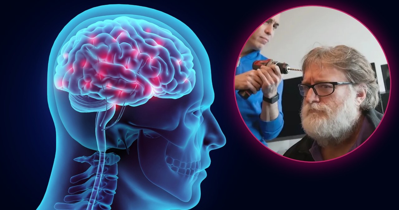 Neuralink ma rywala. Nowy chip mózgowy od szefa Valve w tym roku