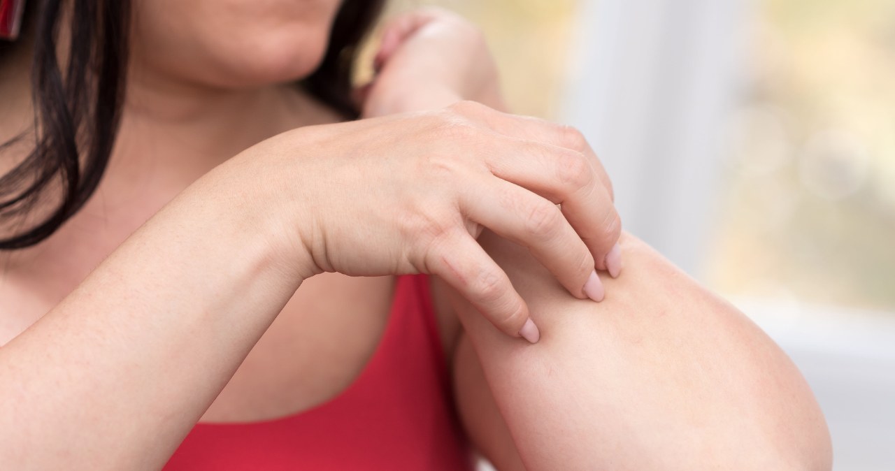 Jak sprawdzić, czy jest się uczulonym na jad pszczoły? Zrób w pierwszej kolejności