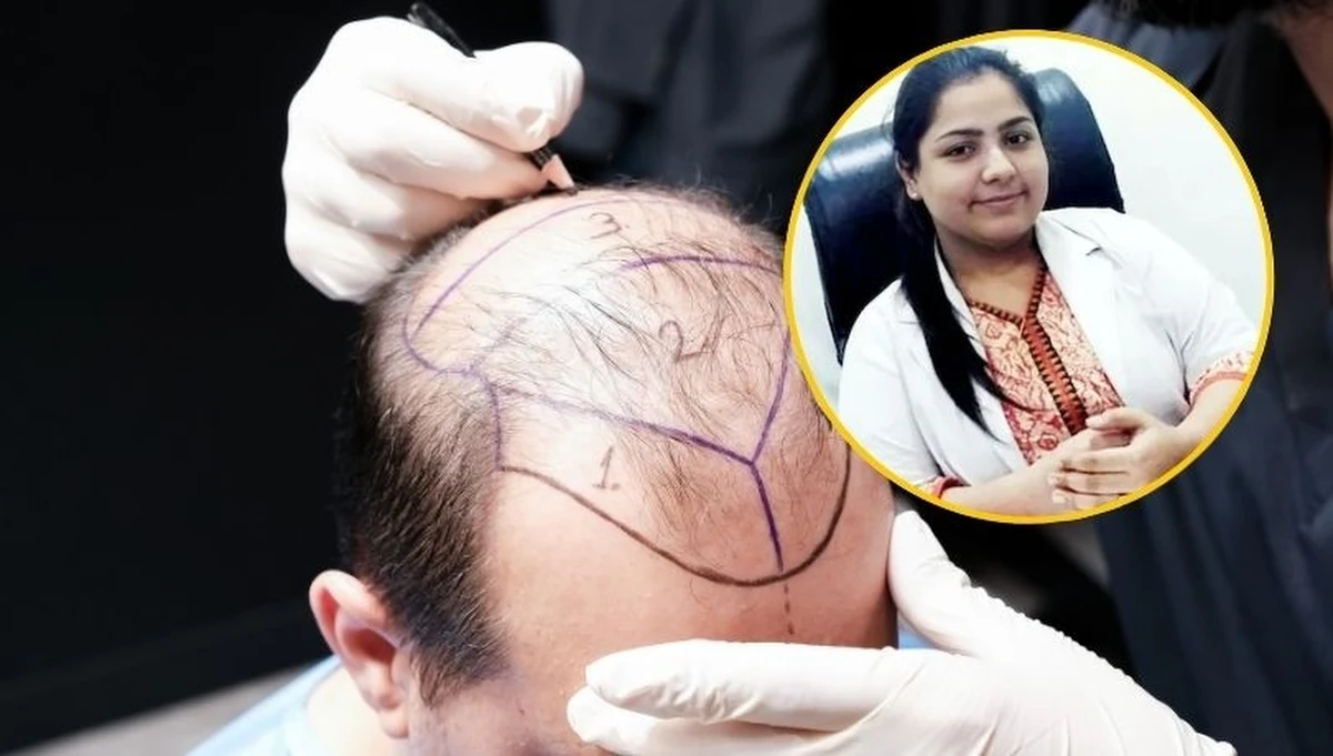 Dwóch mężczyzn zmarło po tym, jak poddali się przeszczepowi włosów. Operację w indyjskim Kanpur przeprowadziła dentystka - dr Anushka Tiwari. Kobieta nie miała żadnych kwalifikacji, została aresztowana.