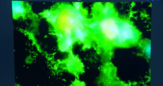 Psy i koty przenoszą otyłość? Sprawdzają to polscy naukowcy