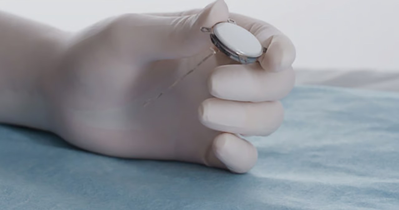 Chiny testują implant mózgowy dla osób po amputacjach