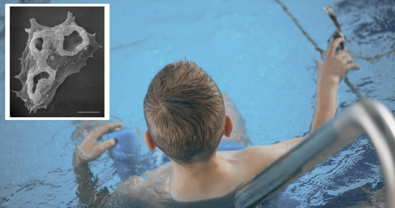 Dziecko zmarło przez amebę zjadającą mózg. Park wodny zamknięto