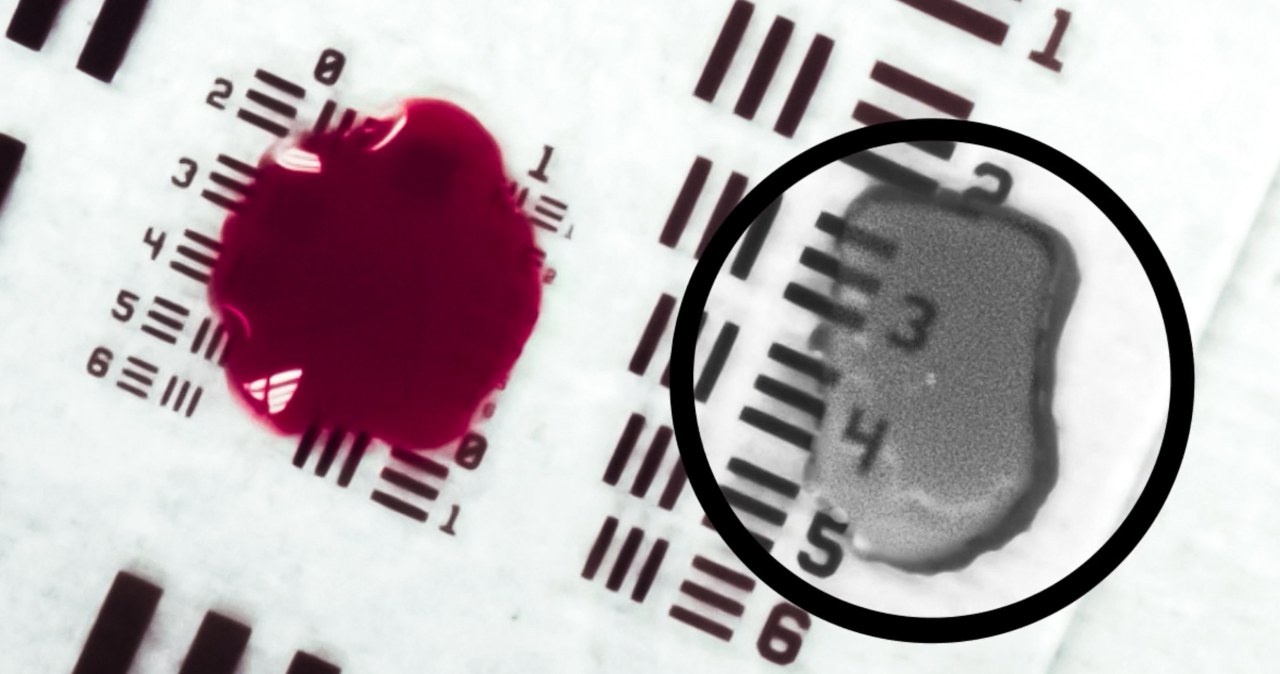 Przełom w chirurgii. Ta technologia pozwala "widzieć przez krew"