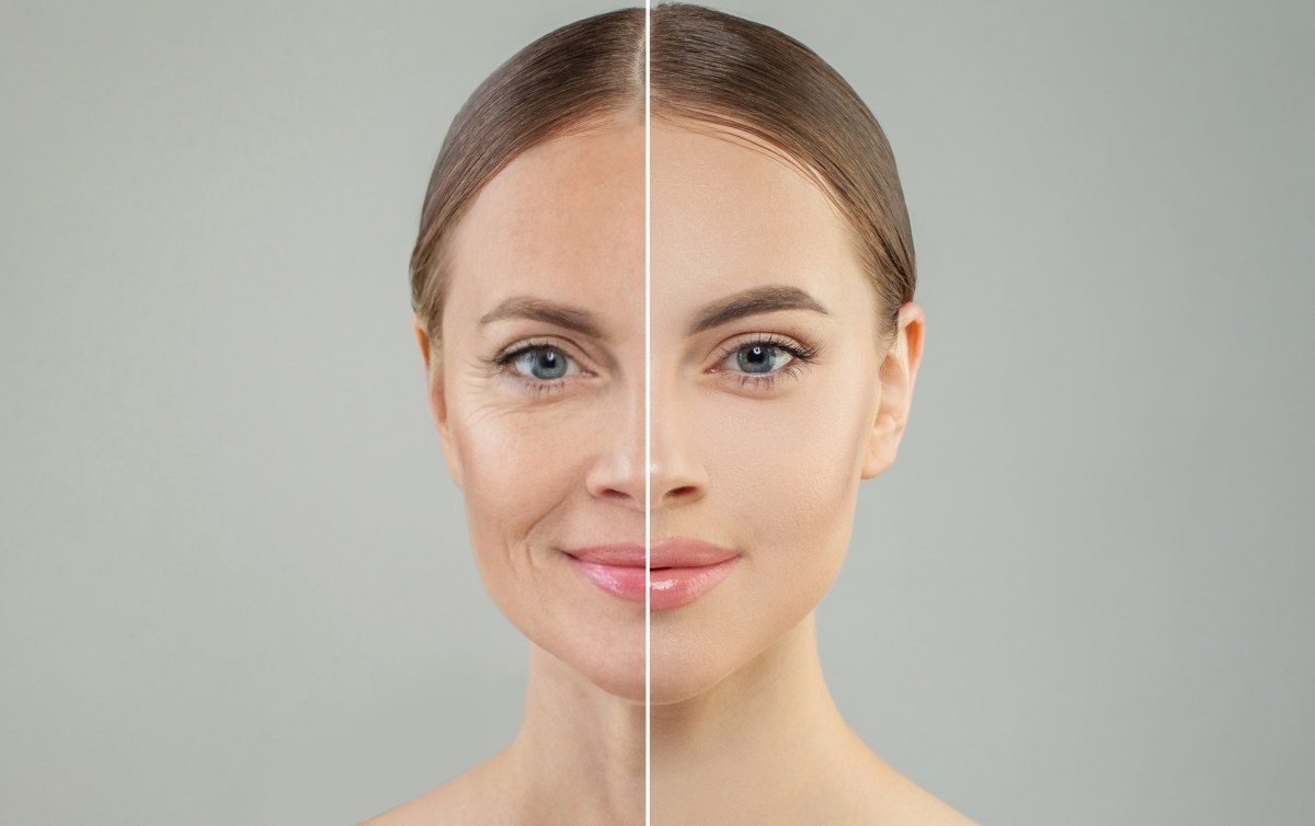 Jak opóźnić starzenie skóry? Oto sprawdzony sposób