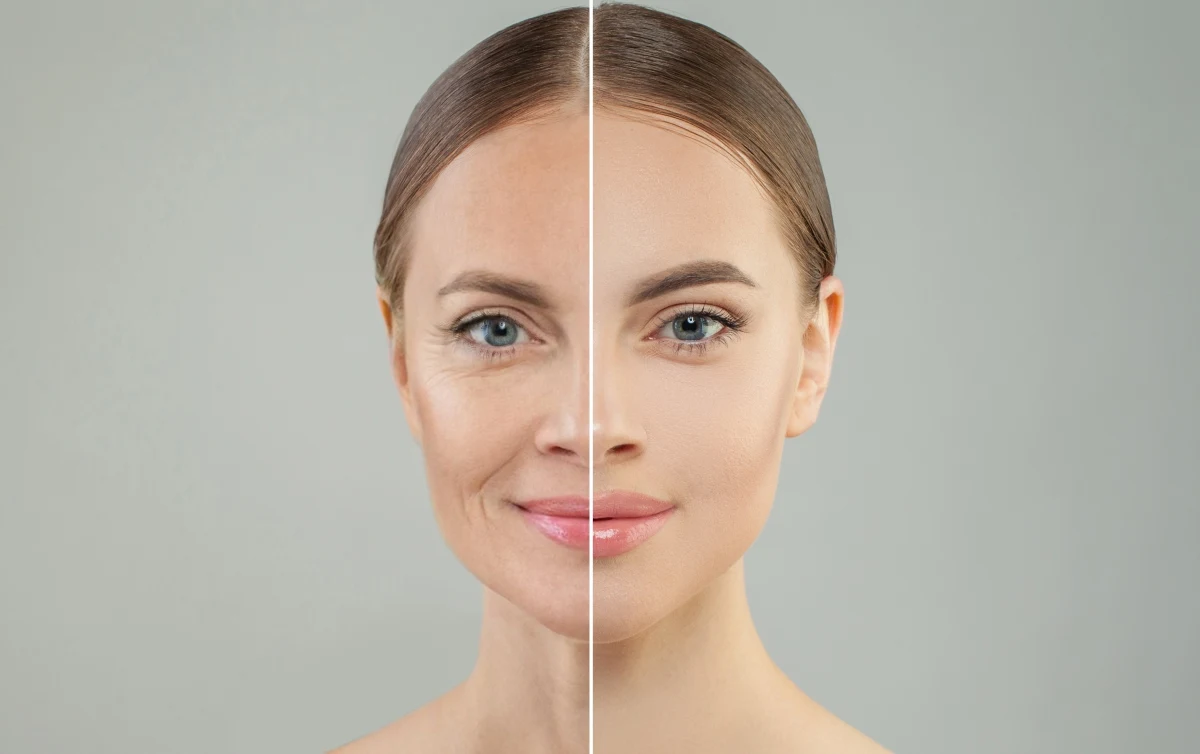 Retinol nie bez powodu należy do kluczowych składników wykorzystywanych w pielęgnacji przeciwstarzeniowej. Choć stosowanie preparatów zawierających pochodną witaminy A rzeczywiście pomaga zachować młody wygląd, nie musimy ograniczać się wyłącznie do sięgania w tym celu po serum lub krem. Retinol znajdziemy bowiem także w żywności - m.in. w wątróbce, mleku oraz jajkach.