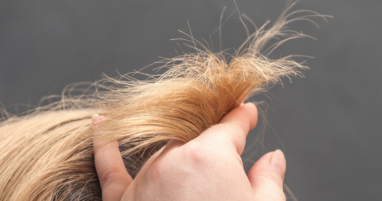 Koniec z suchymi i łamliwymi kosmykami. Poskromisz włosy olejem ze sklepu