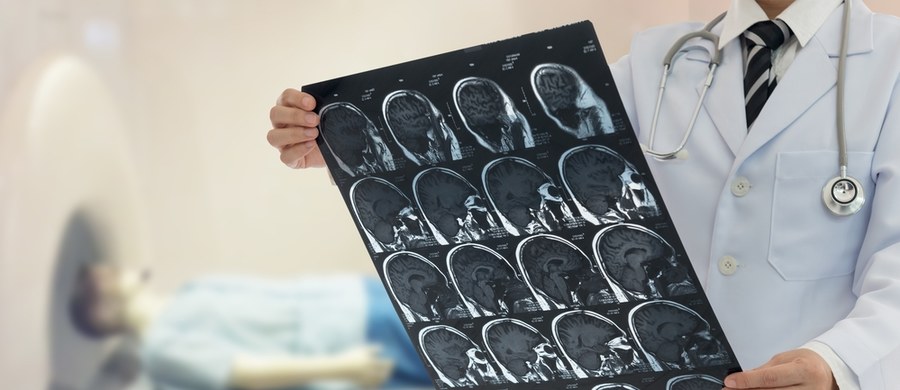 Dojrzałe owoce wyglądem i aromatem zachęcają do tego, żeby je jeść tak od razu, najlepiej bezpośrednio z krzaka albo tuż po zakupach. To ogromny błąd - przestrzega na swoim profilu na Instagramie ratownik medyczny Jan Świtała i jako dowód opublikował zdjęcie rezonansu magnetycznego pacjenta.