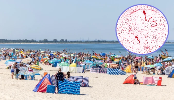 Potwierdzony przypadek wibriozy. Co to za choroba i jakie są objawy? 