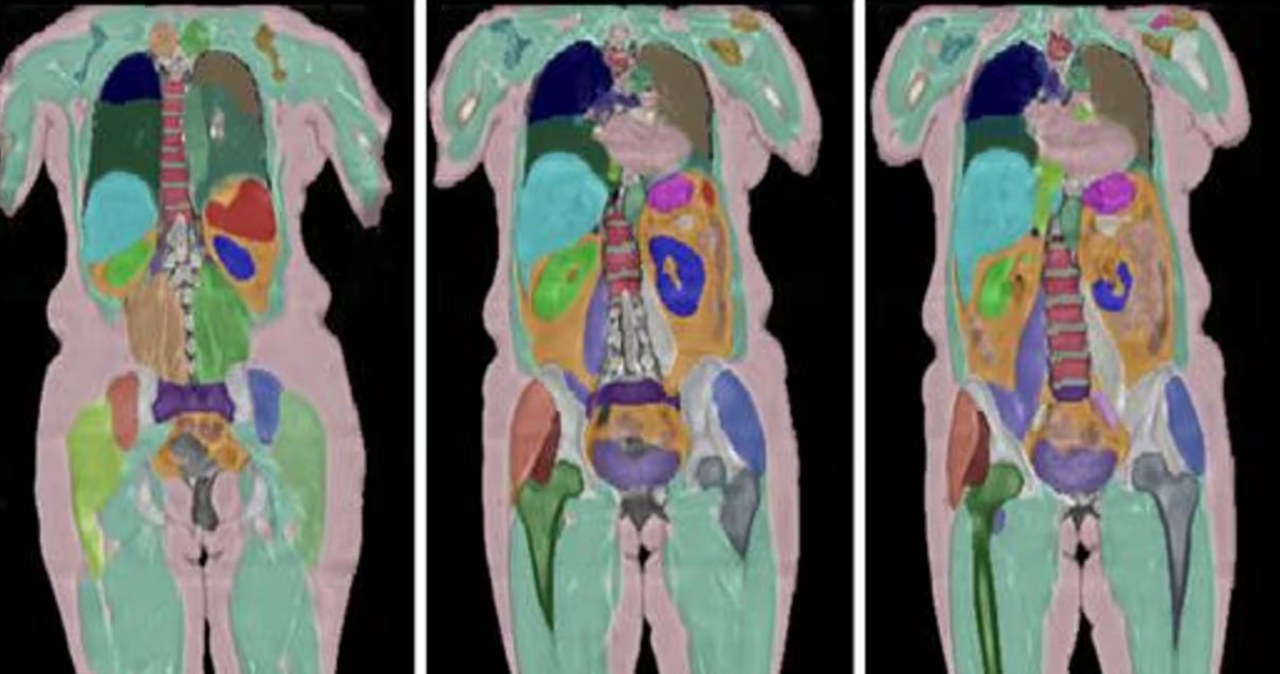 Przeskanowali 100 tys. osób. Odkryli, jak się starzejemy