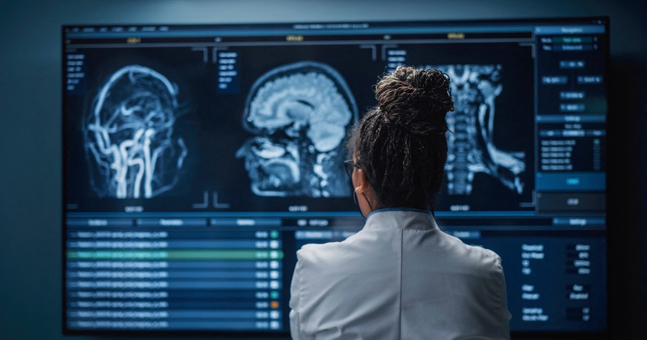 Stwardnienie rozsiane może niszczyć mózg wiele lat przed diagnozą