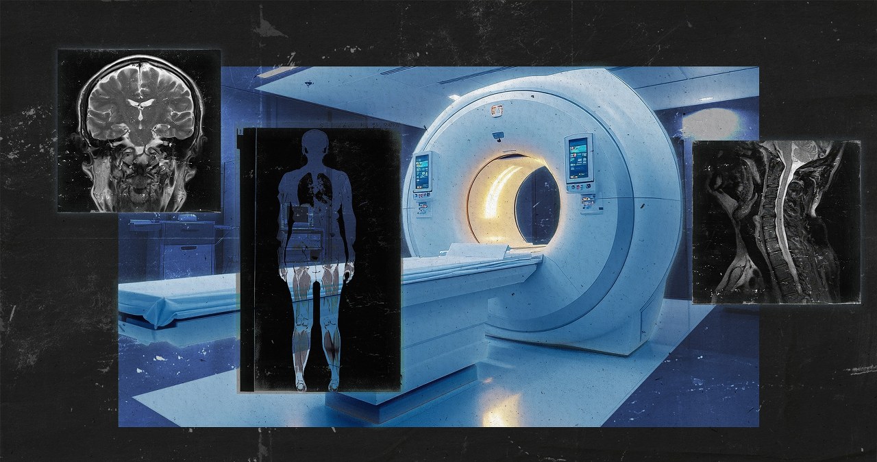 wiadomości,aktualności,Interia Jedno z najbardziej ambitnych badań, jakie kiedykolwiek przeprowadzono. Przeskanowali 100 tys. osób