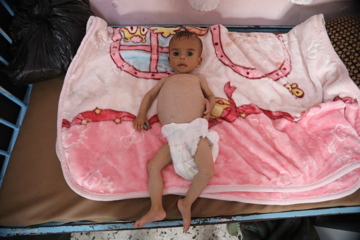 ​Dzieci konają z głodu w Strefie Gazy. "Pojawił się nowy zabójca"