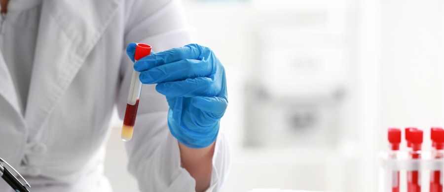 Rzecznik prasowy Głównego Inspektora Sanitarnego przekazał, że znane są już wstępne wyniki badań pacjentki ze Stargardu, u której podejrzewano cholerę. „Wskazują na to, że nie jest to szczep toksynotwórczy. Na pewno nie jest to cholera” – stwierdził. 