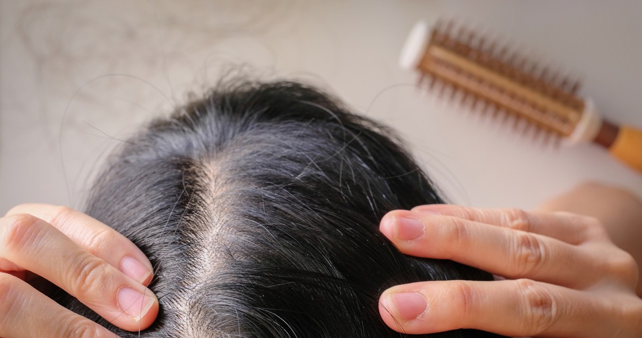 Siwe włosy znikają bez farby. Kobiety zachwycone tym domowym sposobem